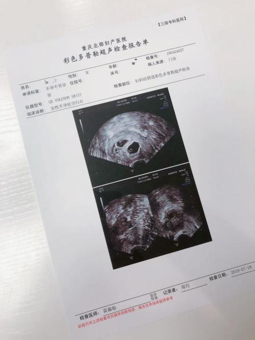 借卵试管代怀咨询【借卵试管代怀咨询:一站式解决您的代怀孕疑惑】