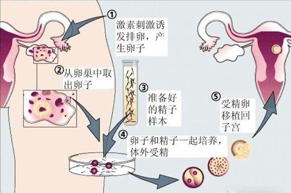借卵试管代怀安全吗_借卵试管代怀安全吗，需要了解的关键信息